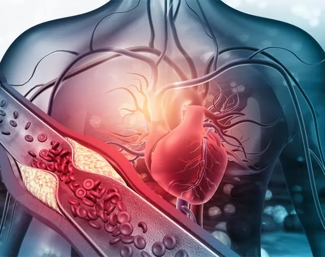 Waspada terhadap kematian jantung mendadak: memamerkan pembunuh vaskular senyap yang diabaikan dan bagaimana Vitamin K2 melindungi jantung