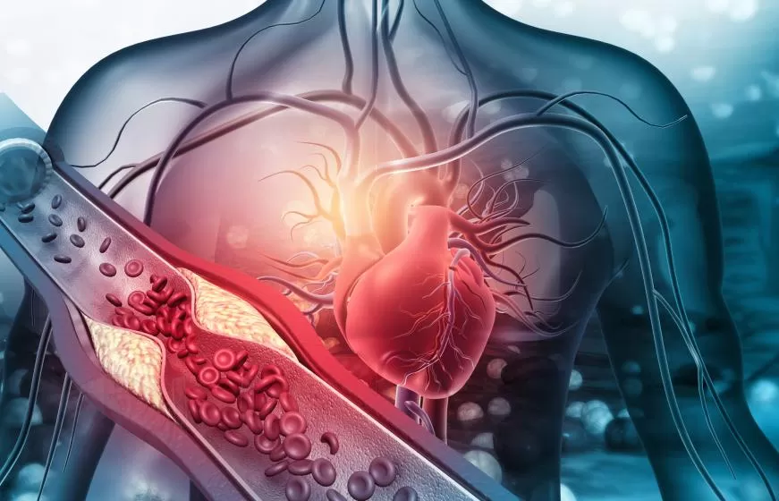 unveiling the overlooked silent vascular killer and how vitamin k2 builds a protective barrier for the heart
